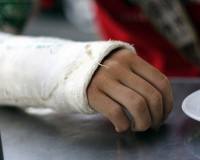 Мужчине, сломавшему жене руку, грозит до восьми лет лишения свободы