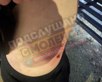 В Заднепровском районе свора бродячих собак напала на женщину