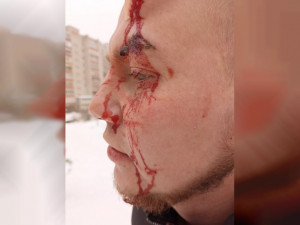 В Смоленске неизвестные избили молодого парня
